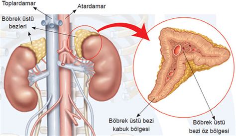 Böbrek Üstü Bezi İltihabı Belirtileri ve Tedavisi