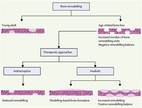 Osteoporosis The Lancet