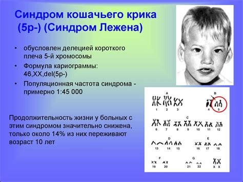 Наследственность и патологии. Хромосомные болезни. Лекция 7 ...