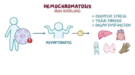 Hemochromatosis Clinical Sciences Osmosis Video Library