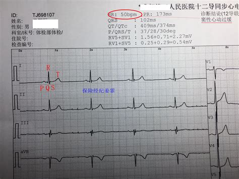 如何看懂体检报告？ 知乎