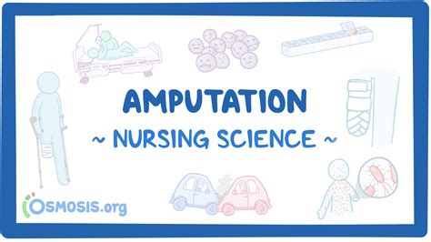 Amputation Nursing Video Causes Osmosis