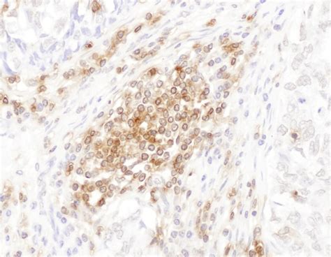 CD45 Antibody (A304-376A)