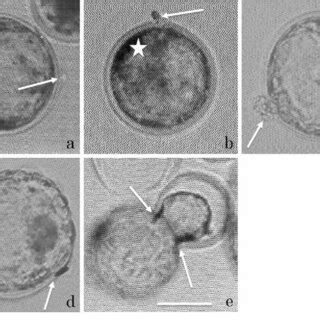 Hatching patterns of cultured cattle blastocysts developed from fresh ...