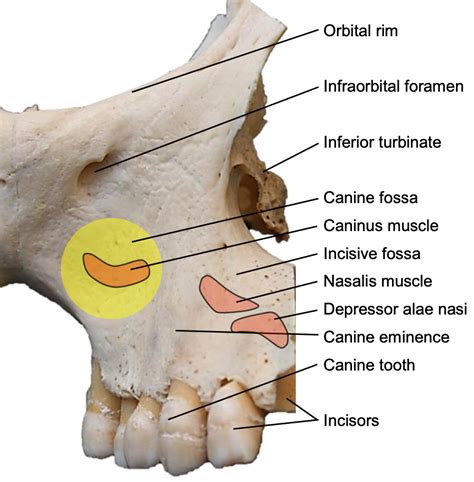 Surco Infraorbitario Del Maxilar
