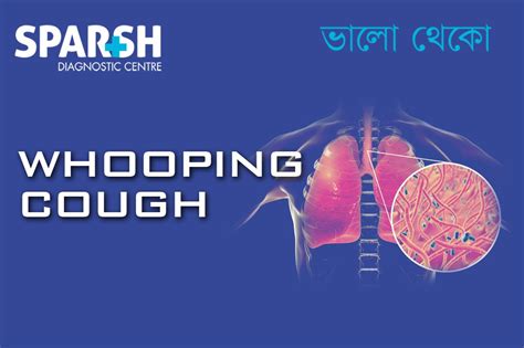 Whooping Cough Pertussis Sparsh Diagnostic Center