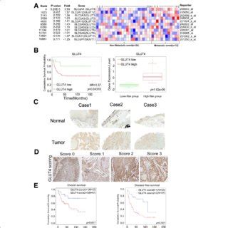 Glut Expression Is Positively Correlated With Metastasis Ability In