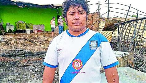 Padre Sufre Quemaduras Al Salvar A Su Hijo En Incendio En Sullana