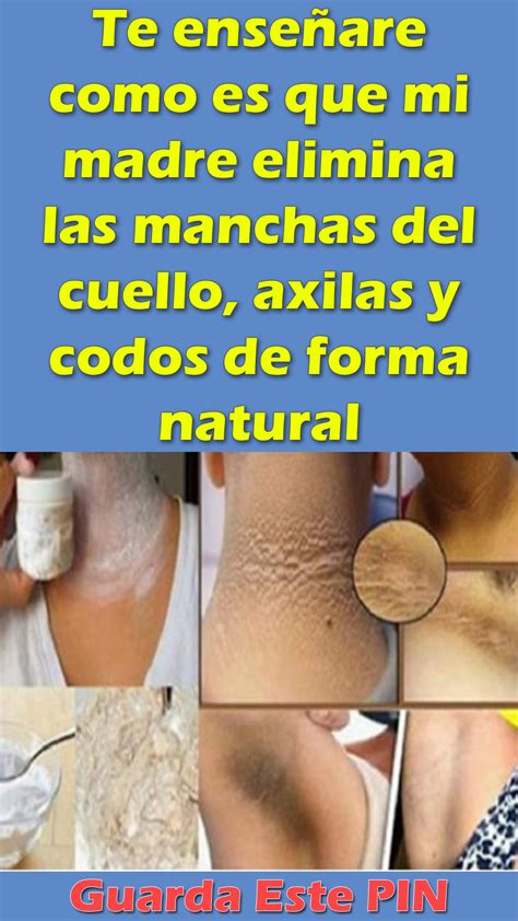 Te enseñare como es que mi madre elimina las manchas del cuello axilas