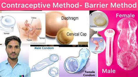 L 25 Contraceptive Method Barrier Contraceptive Method Condom