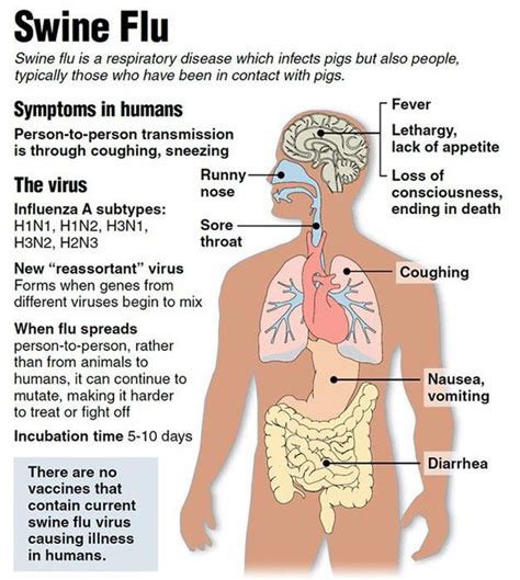 Things You Need To Know About Swine Flu Derek Time