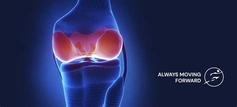 Cartilage Repair Cartilage Surgery Knee Cartilage Injury Symptoms