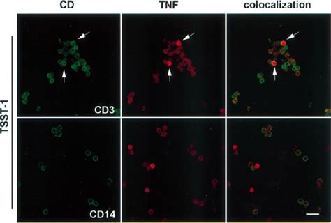 Confocal Microscopy Double Immunofluorescence For Tnf α And Cell