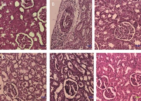 Histological Observation In Renal Sections Hematoxylin And Eosin