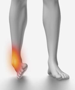 Ankle Sprain vs. Ankle Fracture | Advanced Ortho and Spine