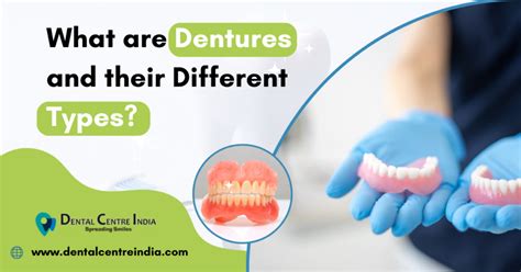 What Are Dentures And Their Different Types Dental Clinic Nearby