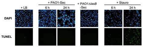 Confluent Hcmec D3 Cell Cultures Were Exposed For Up To 24 H In Low Fcs Download Scientific