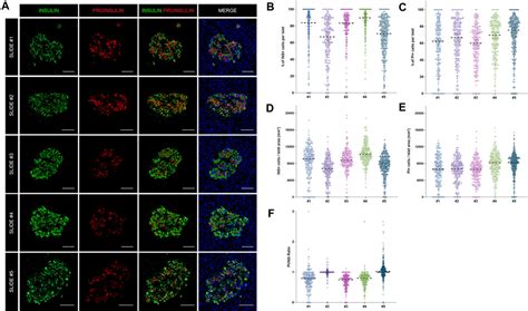 Frontiers Whole Slide Image Analysis Of Human Pancreas Samples To