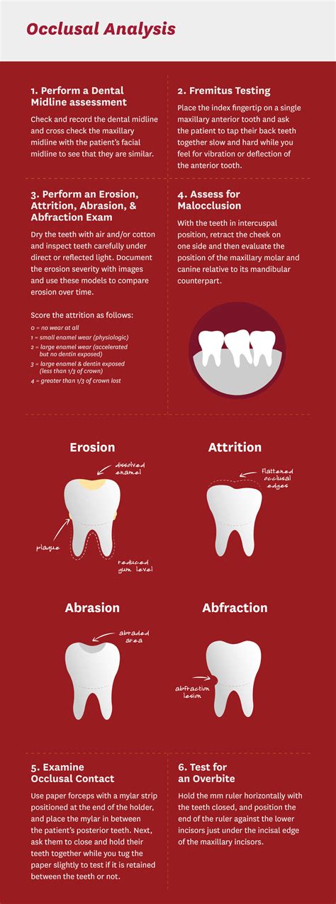 The Dentists Guide To Tooth Erosion Attrition Abrasion And Abfraction