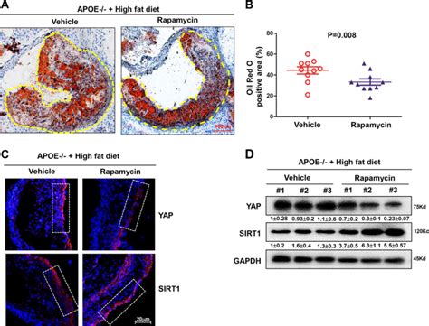 Laminar Flow Inhibits The Hippo Yap Pathway Via Autophagy And Sirt