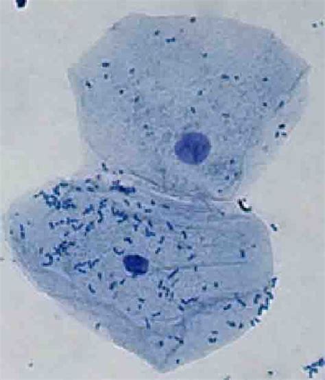 Cheek Cells 400x Stained