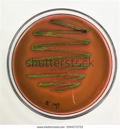 Escherichia Coli On Eosin Methylene Blue Stock Photo 1044572752