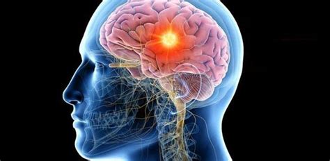 Un nuevo fármaco inmunológico muestra eficacia contra el tumor cerebral