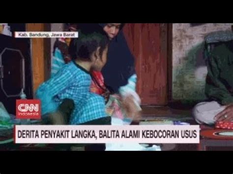 Derita Penyakit Langka Balita Alami Kebocoran Usus YouTube