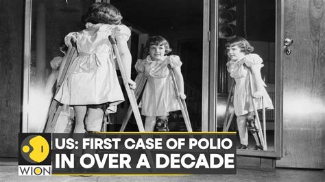 The First Us Case Of Polio Since 2013 Has Been Detected In New York Latest World News Wion