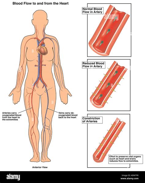 Circulatory collapse hi-res stock photography and images - Alamy