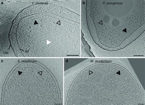 Electron Cryotomography Of Chemosensory Arrays Different Putative