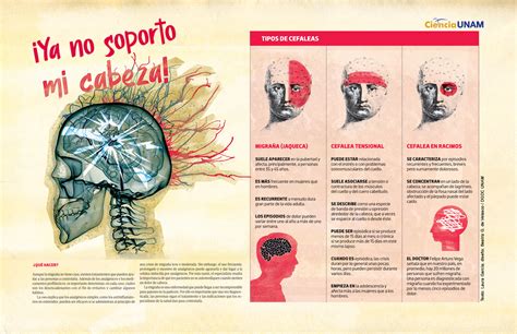 Infograf A Diferentes Tipos De Dolor De Cabeza Ciencia Unam Hot Sex