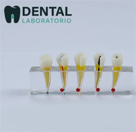 Mixed Dentition Model Explore The Journey Of Dental Growth And