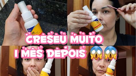 COMO CRESER Á SOBRANCELHA USE AGORA MINOXIDIL 1 mês Usando YouTube