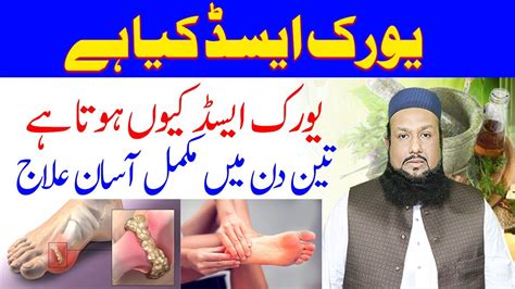 Uric Acid Ka Ilaj High Uric Acid Treatment How To Reduce Uric Acid Hakeem Mehmood Tohidee