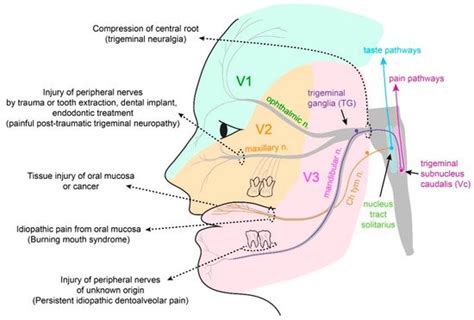 Oral Mucosal Pain Encyclopedia Mdpi