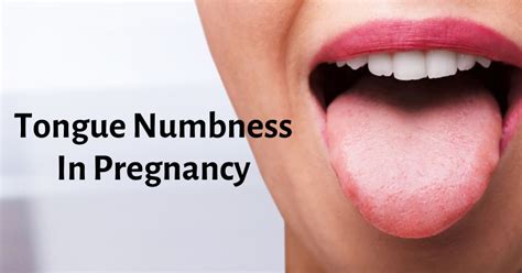 Tongue Numbness In Pregnancy - Reasons & Ways to Ease