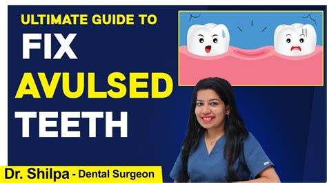 How To Manage Avulsed Teeth Avulsion Teeth Management Dr Shilpa