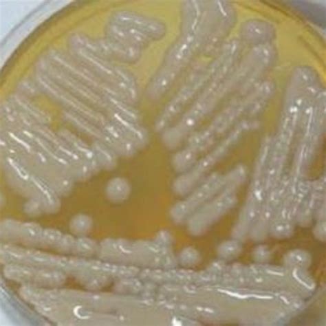 Cryptococcus neoformans on India ink staining. | Download Scientific ...