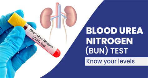 Blood Urea Nitrogen Bun Test Procedure And Uses Star Health