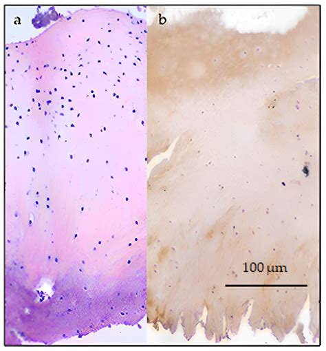 Biomedicines Free Full Text Articular Cartilage Regeneration By