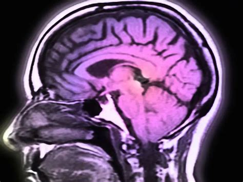 Тиоктовая кислота: описание, инструкция по применению, аналоги и отзывы ...
