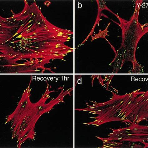 Recovery Of Stress Fibers And Focal Adhesions In Cells Being Washed