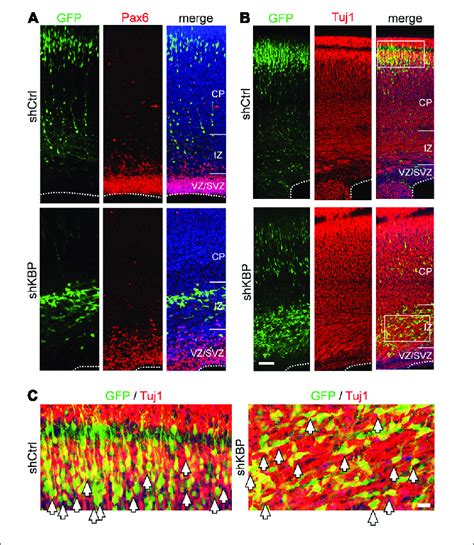 Neuronal Lineage Of Transfected Cells After Iue A Immunostaining