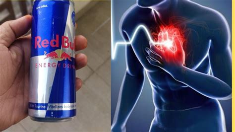 Hidden Dangerous Side Effects Of Red Bull Energy Drinks Youtube