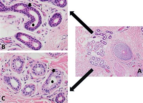 Skin Specimen Section A Skin Specimen With Hair Follicle Apocrine Download Scientific