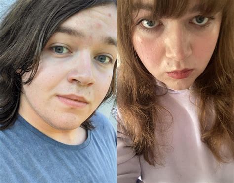 23 Months Before Hrt And After R Transtimelines