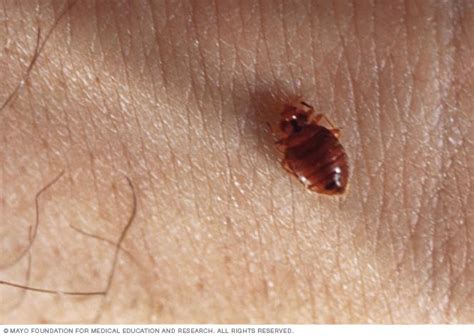 Bedbugs Disease Reference Guide