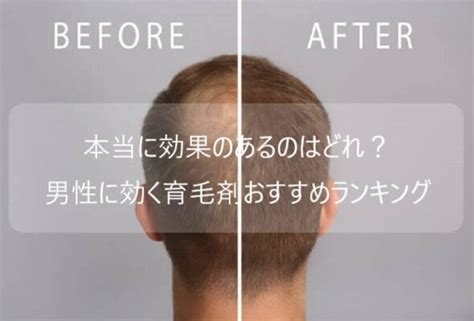 20代～50代男性が効果実感！本当に効果のある育毛剤をランキング