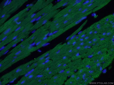 Cardiac Troponin I Antibody 66376 1 Ig Proteintech